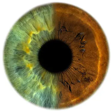 Ditt øye som kunst thumbnail 7